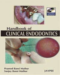 a-hand-book-of-clinical-endodontics