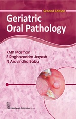 geriatric-oral-pathology