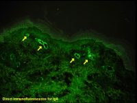 Albert Coons-Immunofluorescence