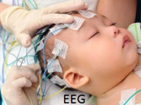 Hans Berger-Electroencephalogram (EEG)